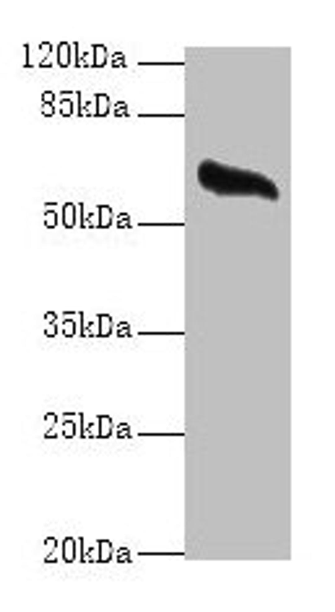 Western blot. All lanes: GPC4 antibody at 8µg/ml + Mouse brain tissue. Secondary. Goat polyclonal to rabbit IgG at 1/10000 dilution. Predicted band size: 63, 55 kDa. Observed band size: 63 kDa