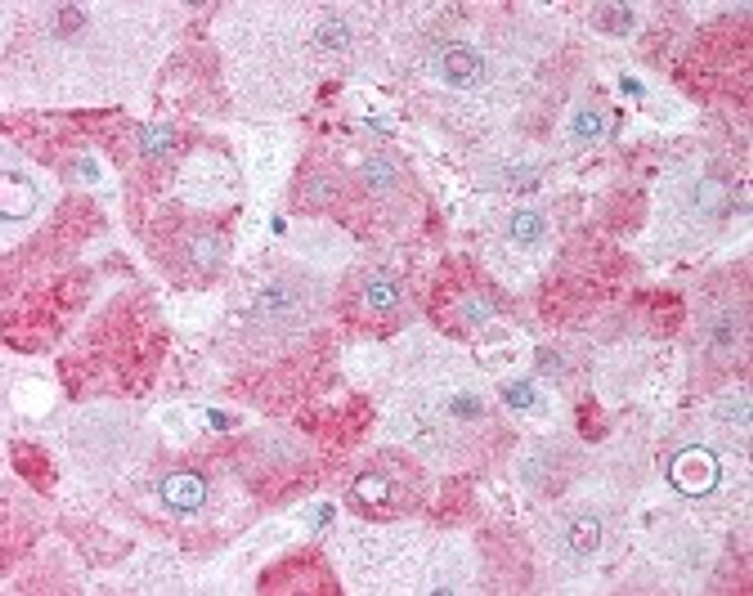 Immunohistochemistry staining of Caspase-4 in liver tissue using Caspase-4 Antibody.