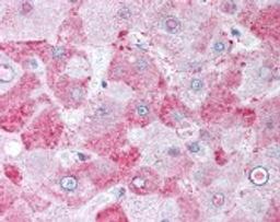 Immunohistochemistry staining of Caspase-4 in liver tissue using Caspase-4 Antibody.