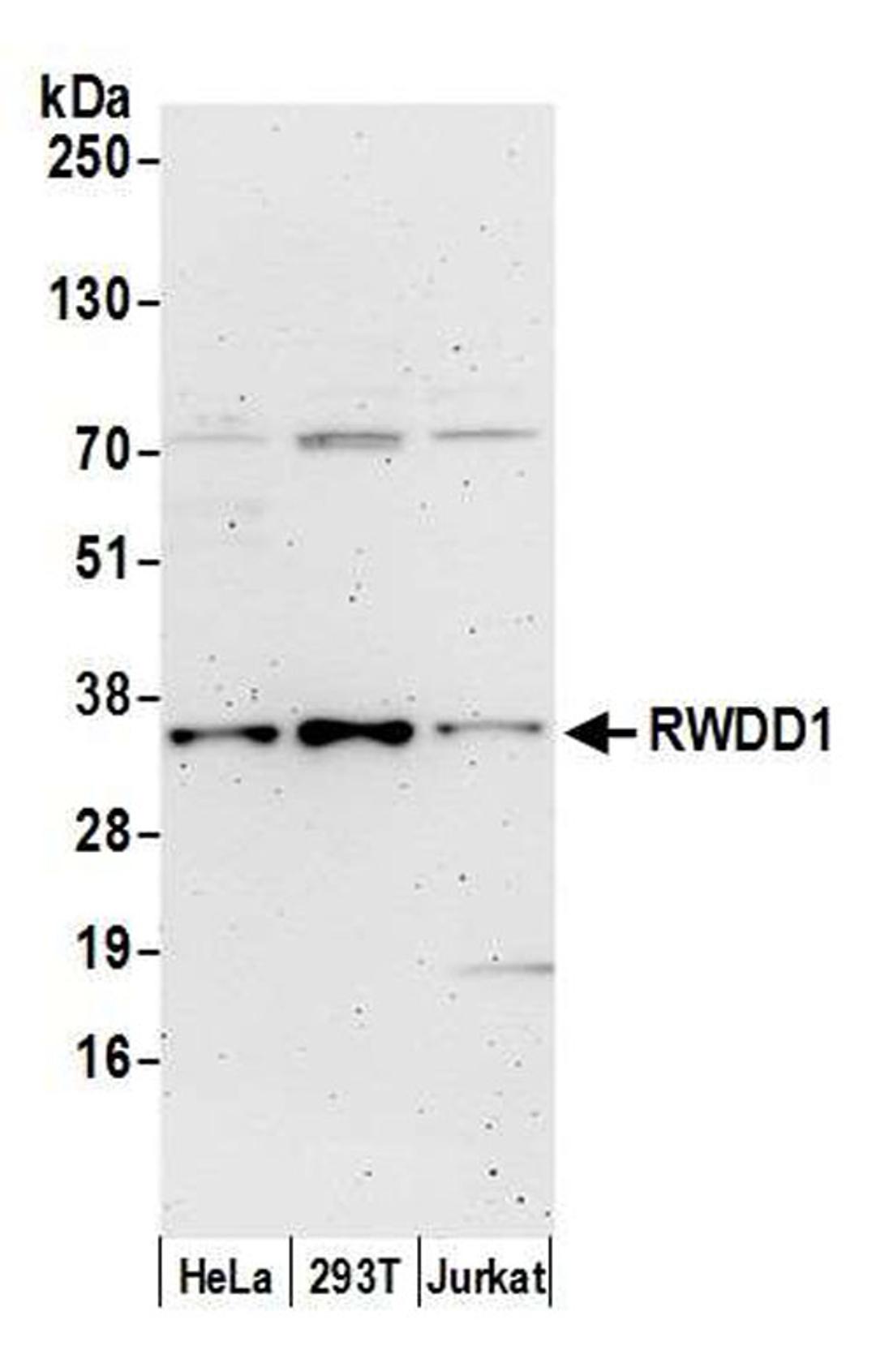 Detection of human RWDD1 by WB.