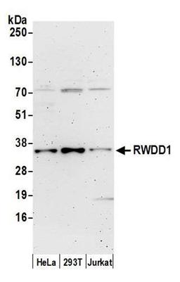 Detection of human RWDD1 by WB.