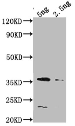 Western Blot. Positive WB detected in Recombinant protein. All lanes: DCM antibody at 1:2000. Secondary. Goat polyclonal to rabbit IgG at 1/50000 dilution. Predicted band size: 36.5 kDa. Observed band size: 34 kDa. 