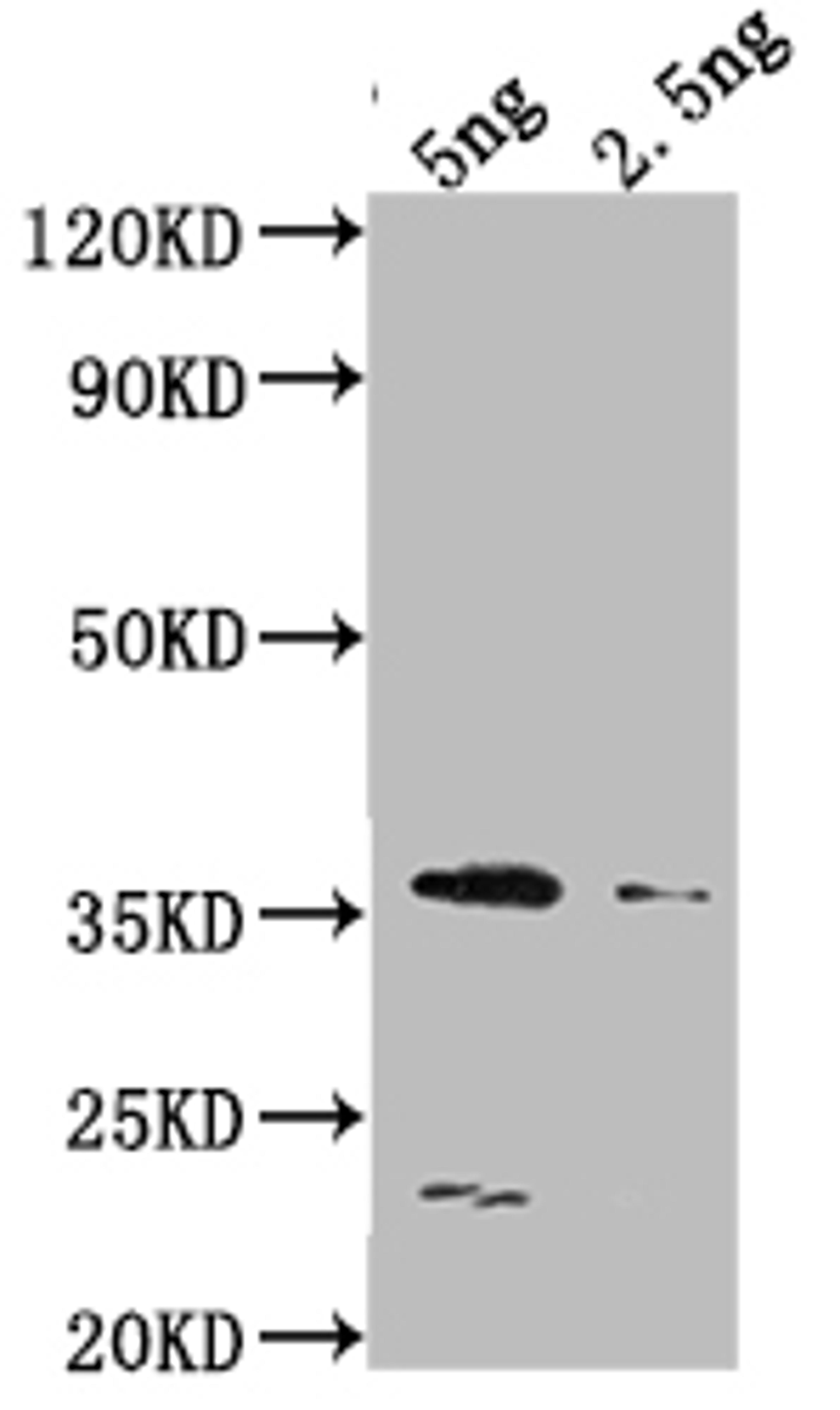 Western Blot. Positive WB detected in Recombinant protein. All lanes: DCM antibody at 1:2000. Secondary. Goat polyclonal to rabbit IgG at 1/50000 dilution. Predicted band size: 36.5 kDa. Observed band size: 34 kDa. 