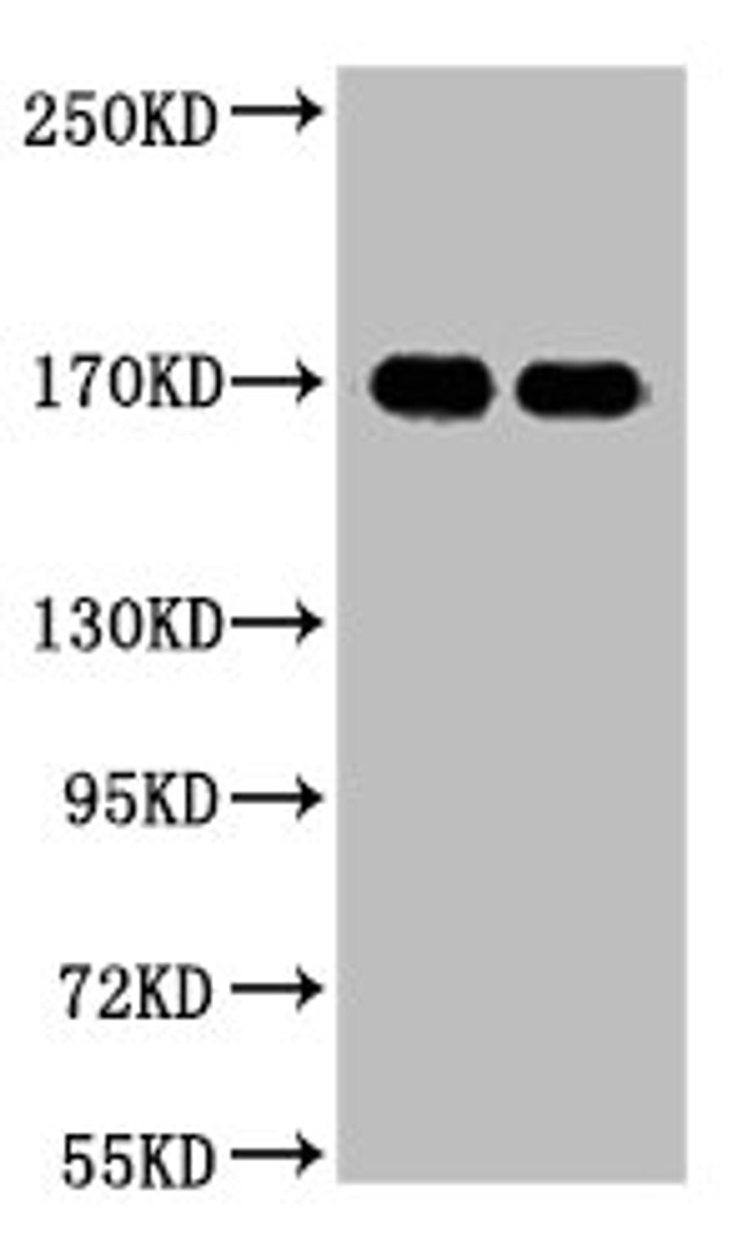 Western blot analysis of 1) A431, 2) Hela, diluted at 1:2000.