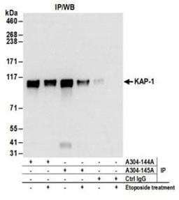 Detection of mouse KAP-1 by western blot of immunoprecipitates.