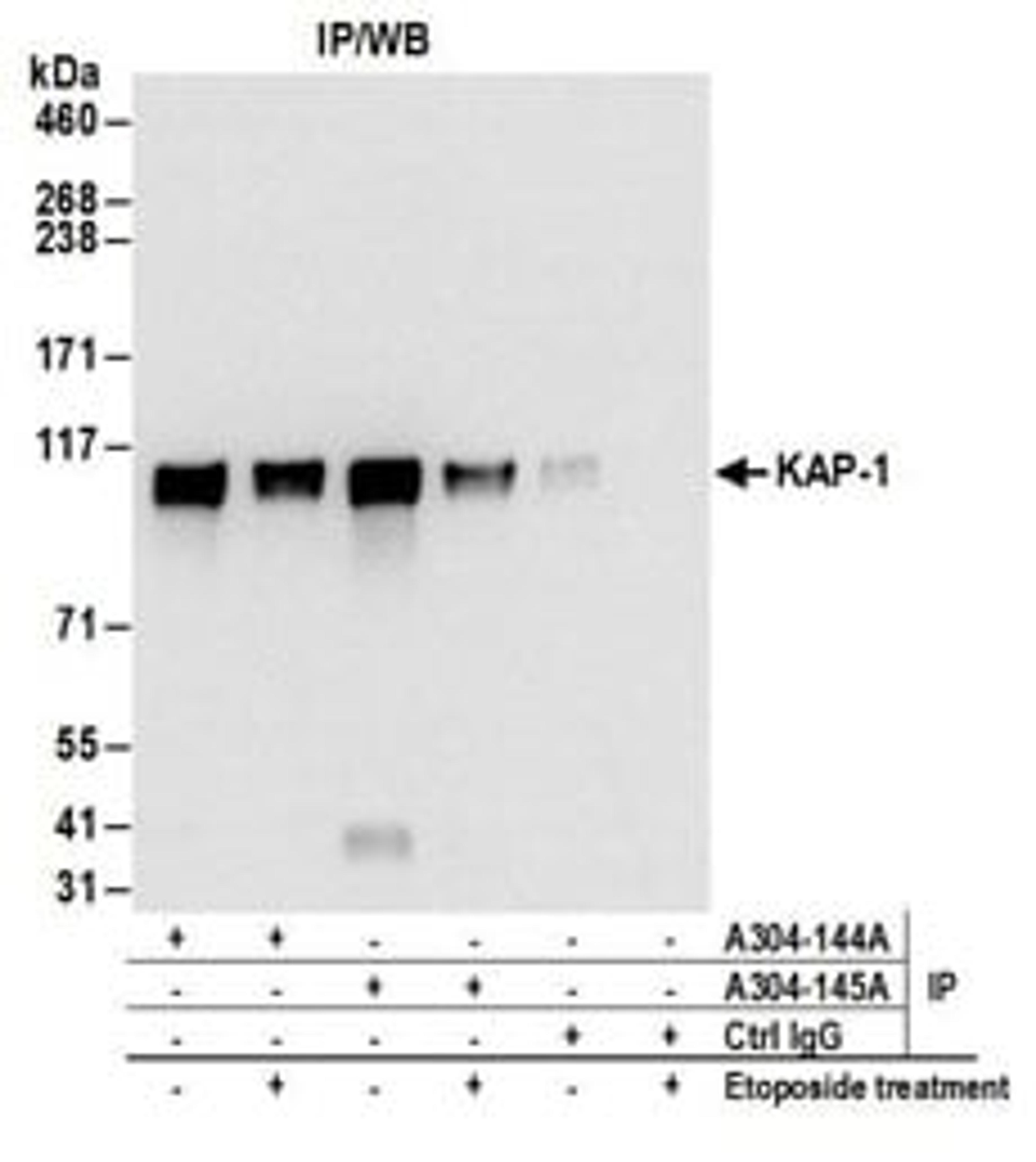 Detection of mouse KAP-1 by western blot of immunoprecipitates.