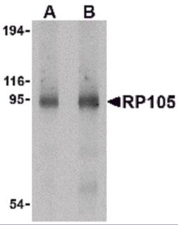 Western blot analysis of RP105 in human spleen tissue lysate with RP105 antibody at (A) 0.5 and (B) 1 &#956;g/mL. 