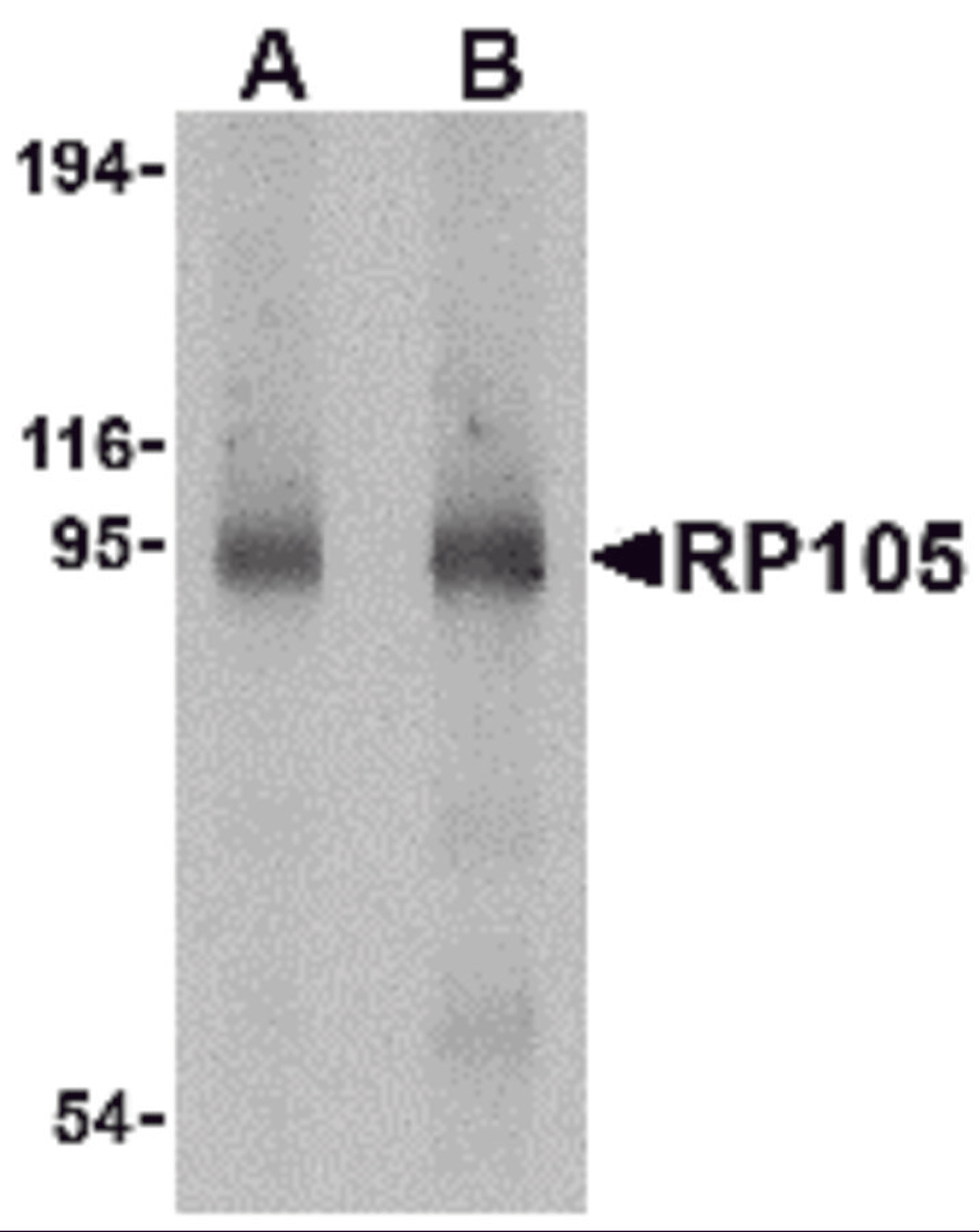 Western blot analysis of RP105 in human spleen tissue lysate with RP105 antibody at (A) 0.5 and (B) 1 &#956;g/mL. 