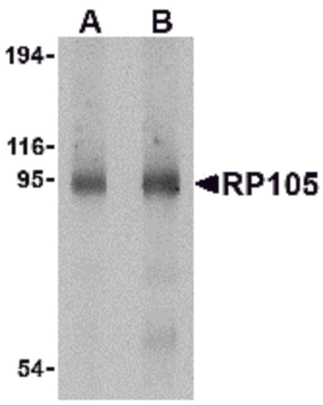 Western blot analysis of RP105 in human spleen tissue lysate with RP105 antibody at (A) 0.5 and (B) 1 μg/mL.