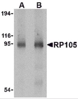 Western blot analysis of RP105 in human spleen tissue lysate with RP105 antibody at (A) 0.5 and (B) 1 μg/mL.