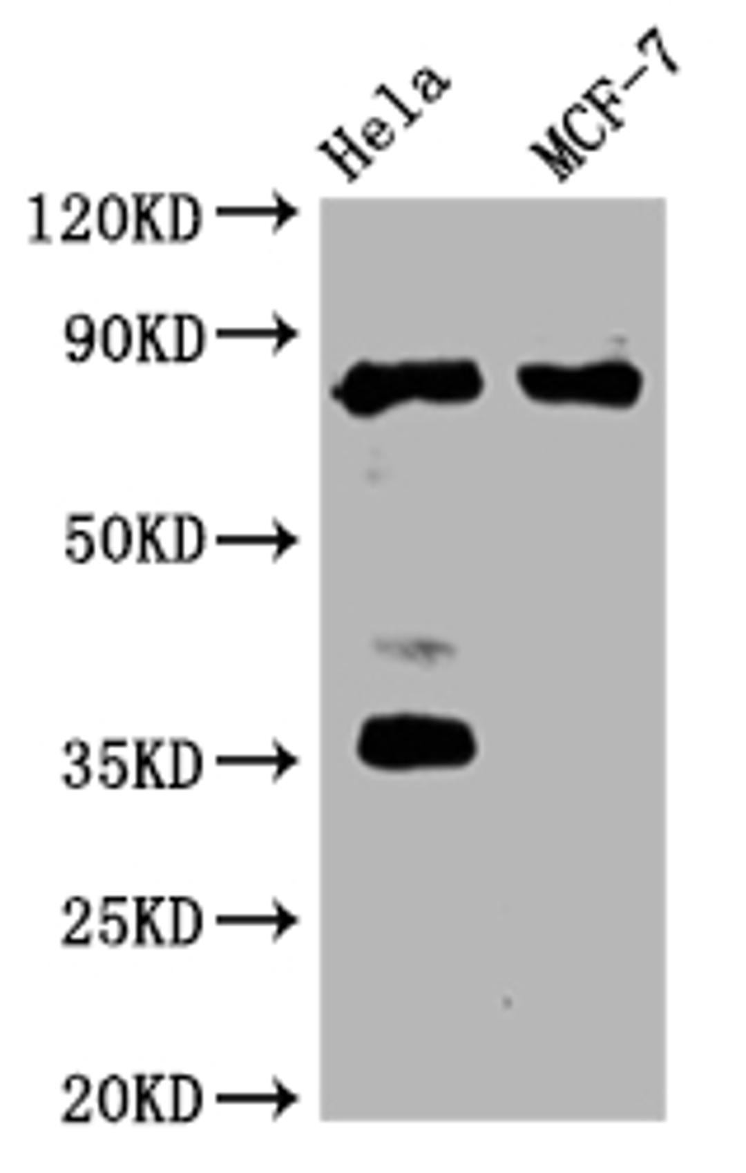 Western Blot. Positive WB detected in:Hela whole cell lysate, MCF-7 whole cell lysate. All lanes: STAT3 antibody at 1:2000. Secondary. Goat polyclonal to rabbit IgG at 1/50000 dilution. Predicted band size: 89, 88, 84 kDa. Observed band size: 89 kDa.