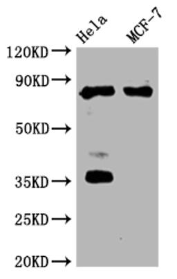 Western Blot. Positive WB detected in:Hela whole cell lysate, MCF-7 whole cell lysate. All lanes: STAT3 antibody at 1:2000. Secondary. Goat polyclonal to rabbit IgG at 1/50000 dilution. Predicted band size: 89, 88, 84 kDa. Observed band size: 89 kDa.