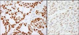 Detection of human and mouse RCC2 by immunohistochemistry.