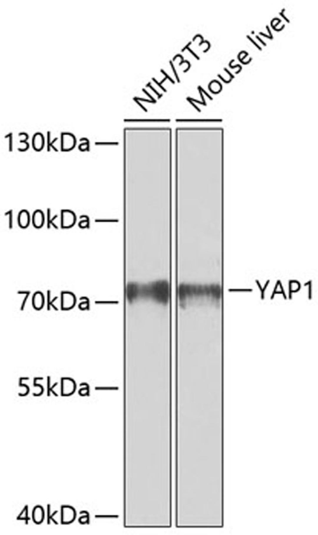 Western blot - YAP1 antibody (A11430)