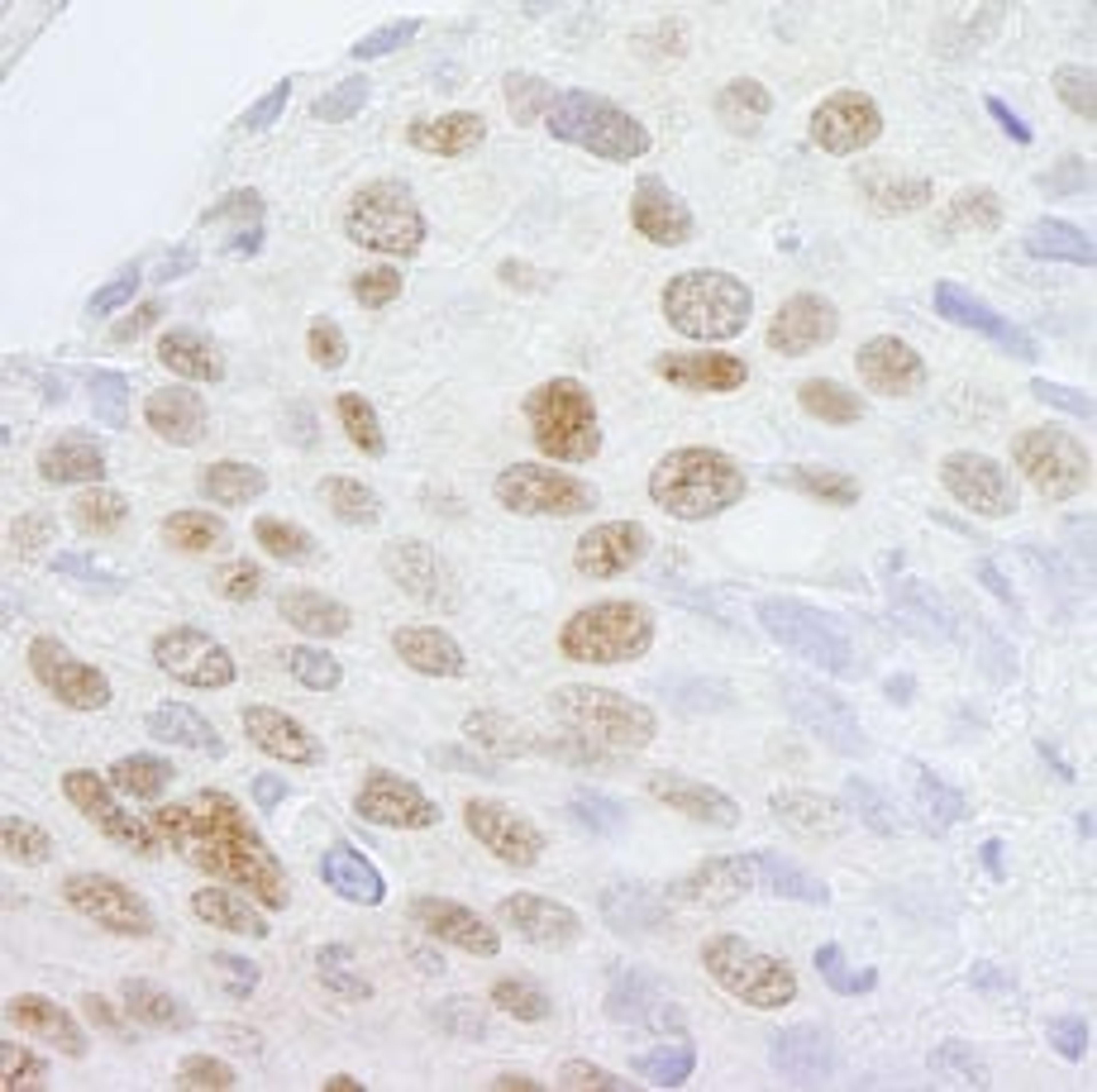 Detection of human ZCCHC8 by immunohistochemistry.