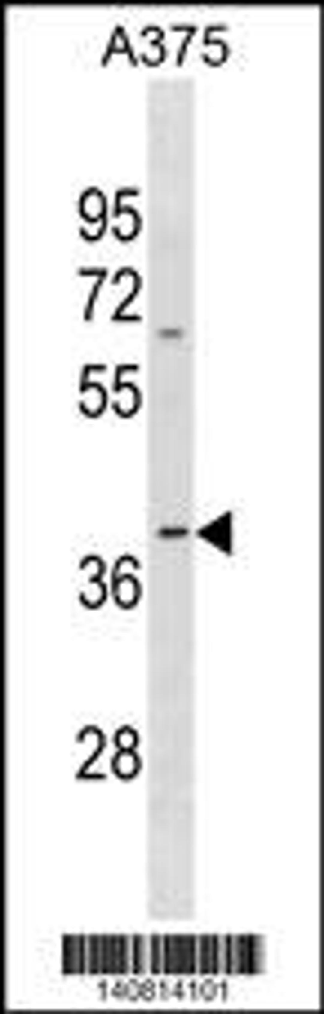 Western blot analysis in A375 cell line lysates (35ug/lane).