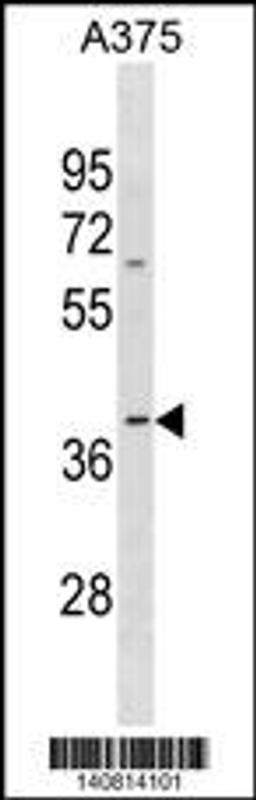 Western blot analysis in A375 cell line lysates (35ug/lane).