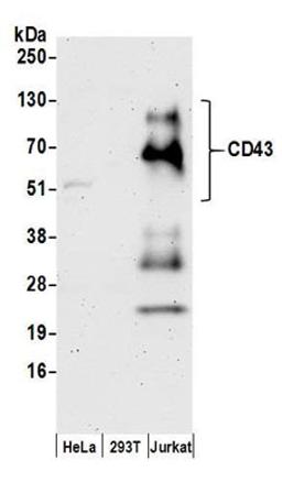 Detection of human CD43 by western blot.