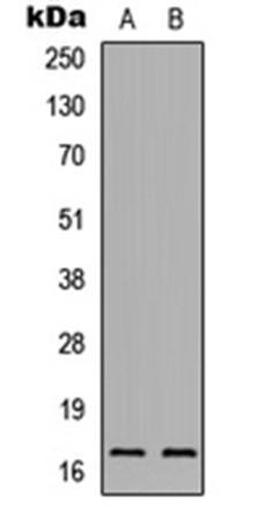 Western blot analysis of HEK293T (Lane1), H9C2 (Lane2) whole cell using IL-1F5 antibody