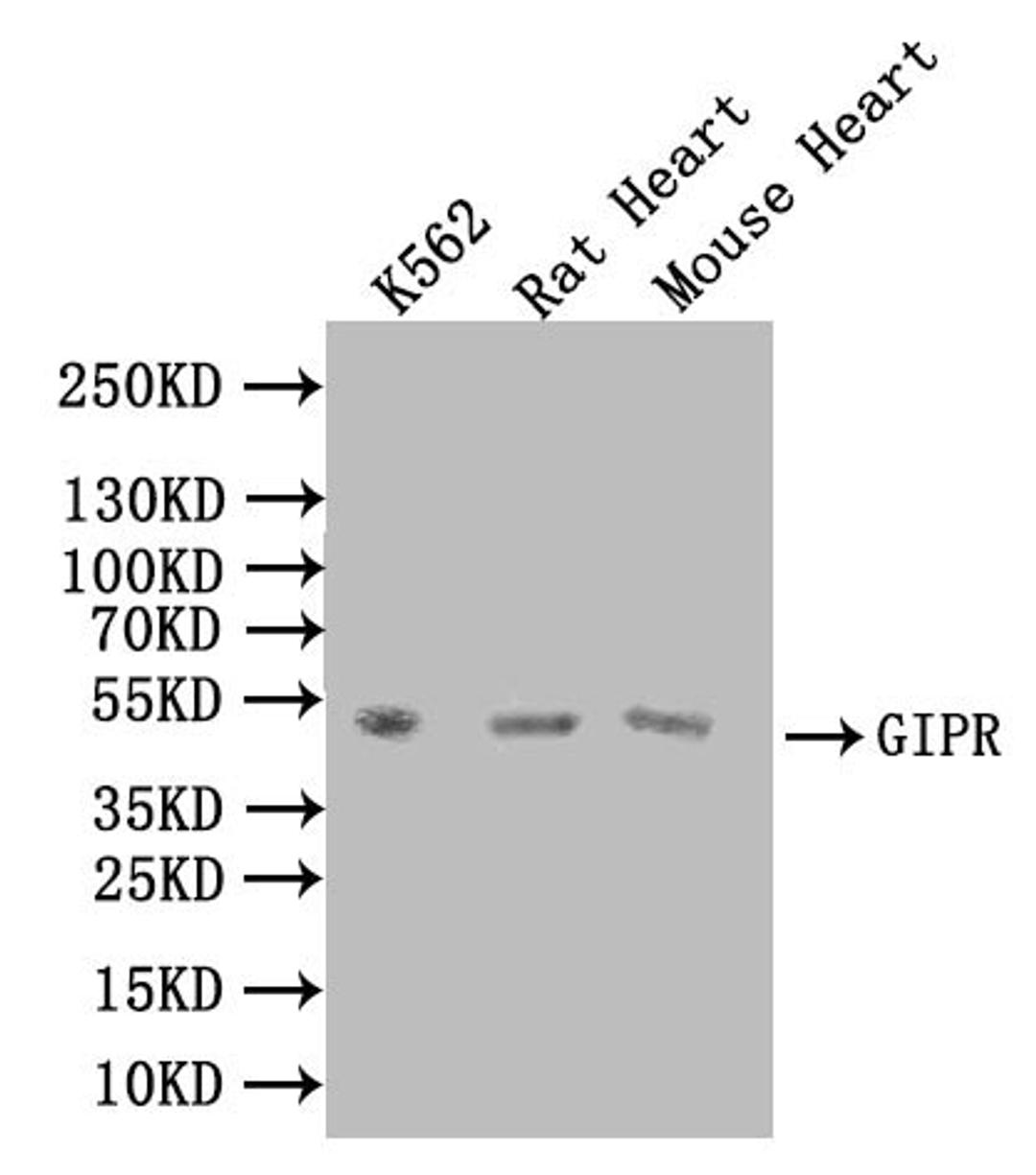 Western BlotPositive WB detected in: K562 whole cell lysate, Rat Heart tissue lysate, Mouse Heart tissue lysateAll lanes: GIPR antibody at 1:1000SecondaryGoat polyclonal to rabbit IgG at 1/50000 dilutionPredicted band size: 54 kDaObserved band size: 54 kDa