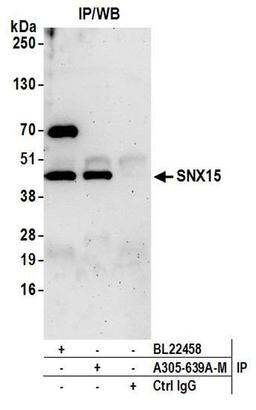 Detection of human SNX15 by WB of IP.