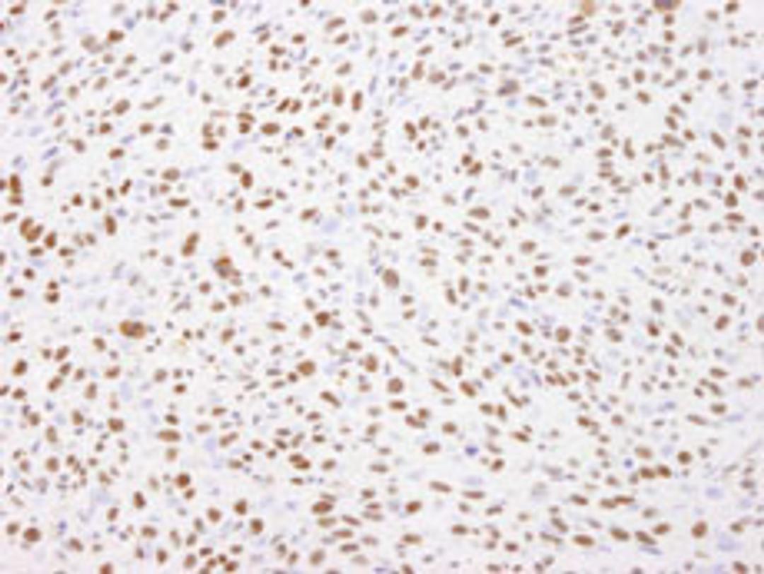 Detection of mouse Nucleolin by immunohistochemistry.