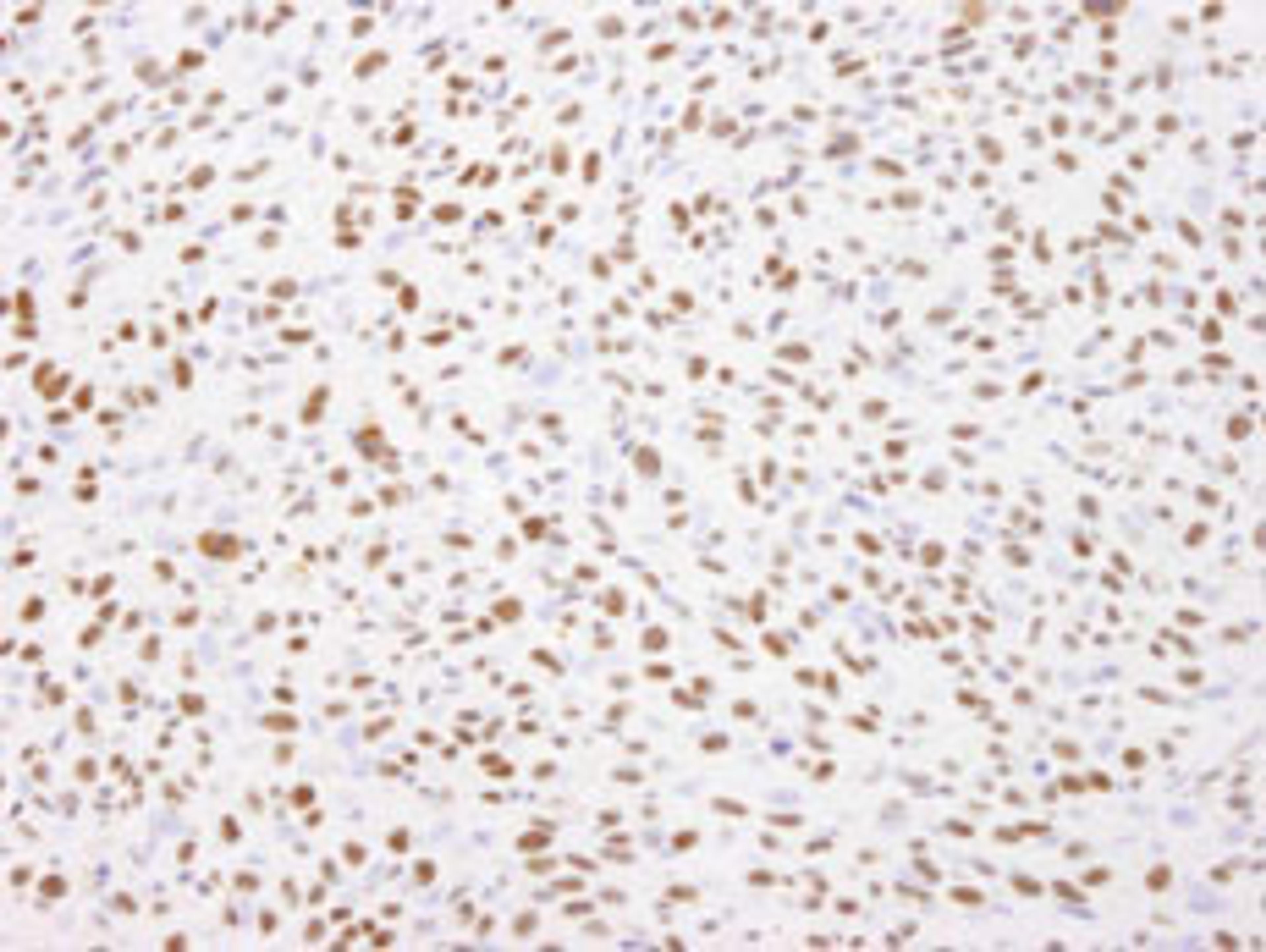 Detection of mouse Nucleolin by immunohistochemistry.