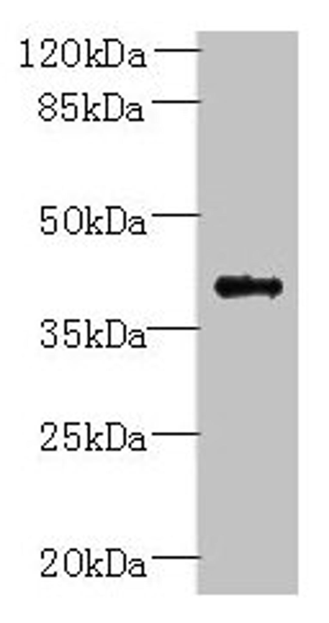 Western blot. All lanes: PSTPIP2 antibody at 6ug/ml + Raji whole cell lysate. Secondary. Goat polyclonal to rabbit IgG at 1/10000 dilution. Predicted band size: 39, 37 kDa. Observed band size: 39 kDa.