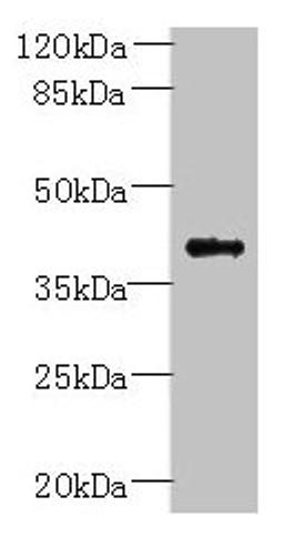Western blot. All lanes: PSTPIP2 antibody at 6ug/ml + Raji whole cell lysate. Secondary. Goat polyclonal to rabbit IgG at 1/10000 dilution. Predicted band size: 39, 37 kDa. Observed band size: 39 kDa.