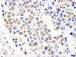 Detection of human FIP1 by immunohistochemistry.