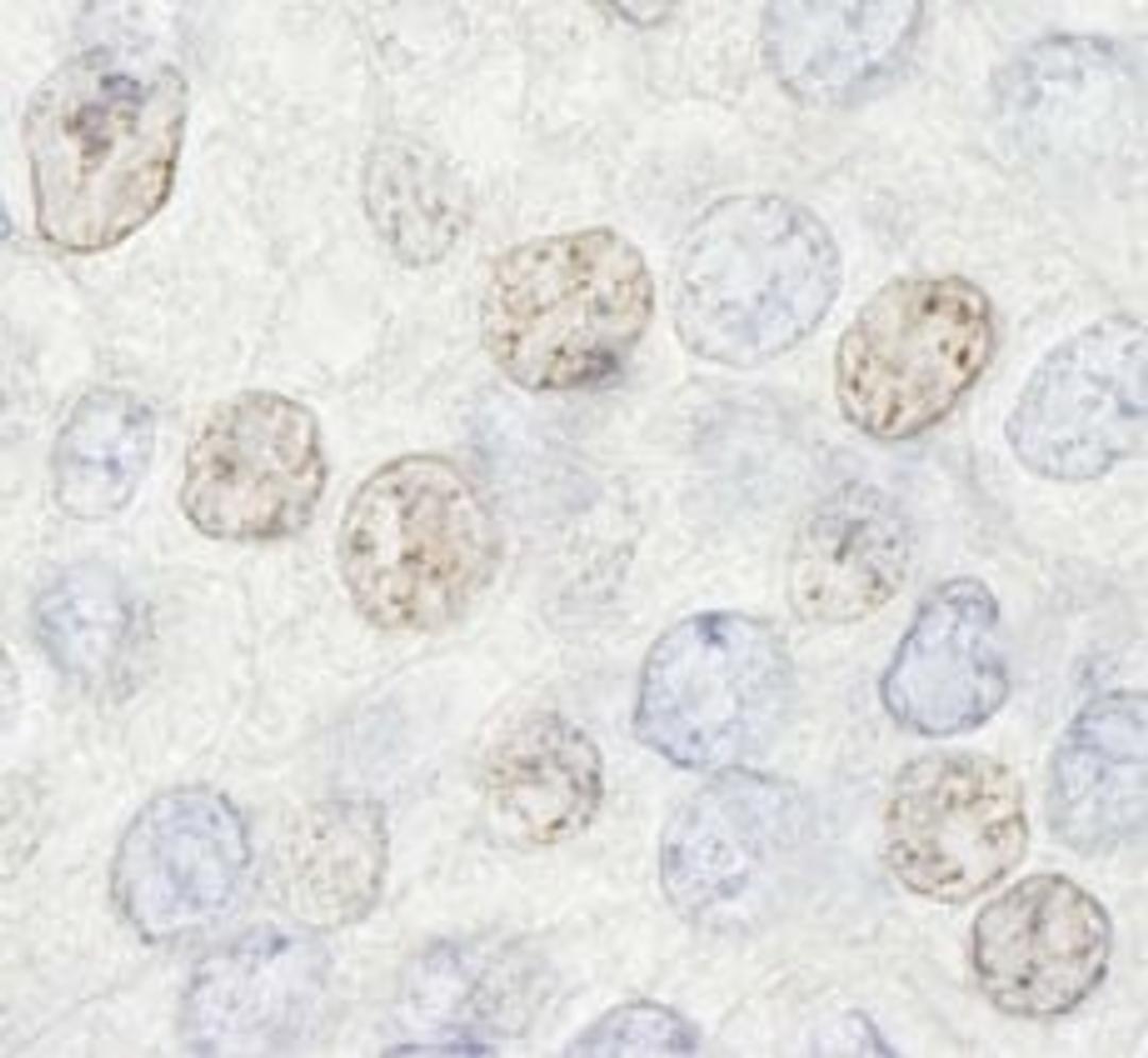 Detection of human HDAC7 by immunohistochemistry.