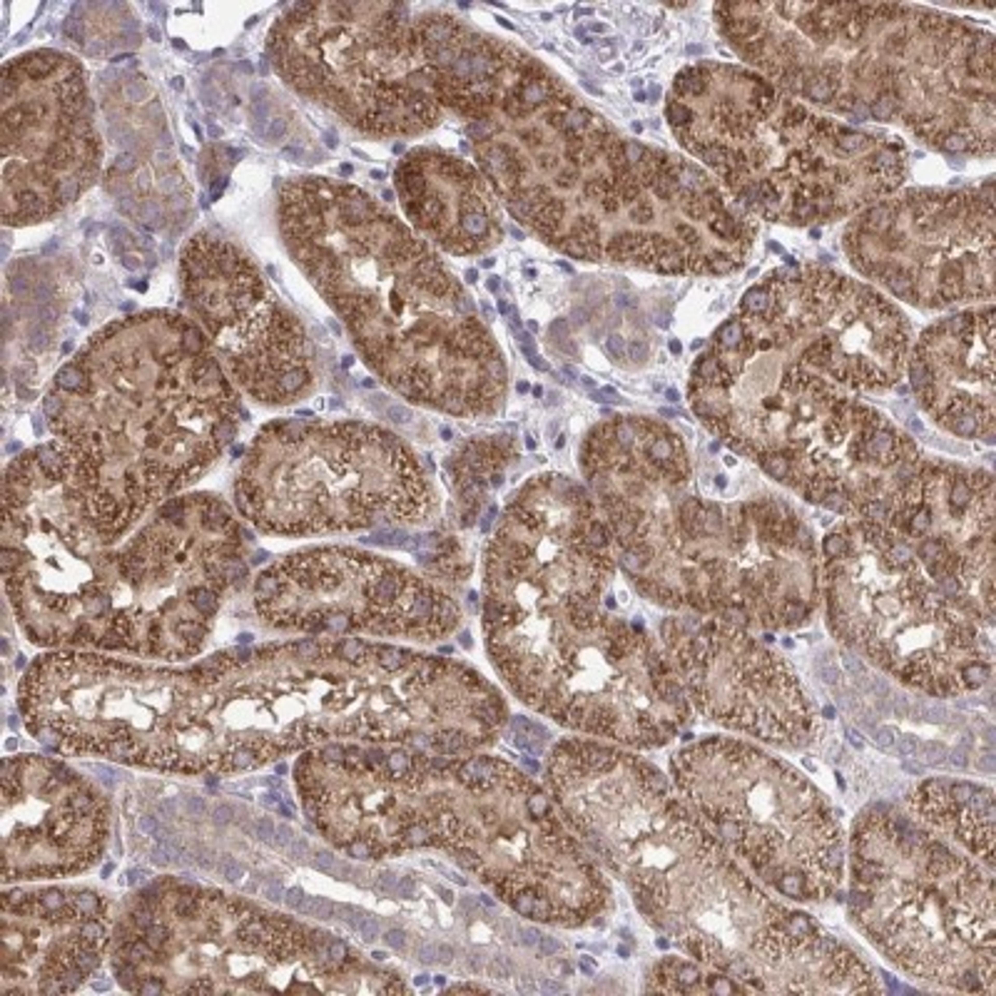 Immunohistochemistry: CEACAM18 Antibody [NBP2-32471] - Staining of human kidney shows strong cytoplasmic positivity in cells in tubules.