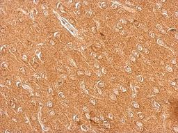 Immunohistochemistry-Paraffin: Chromogranin C Antibody [NBP2-15895] - Cytosol on Mouse Brain; antibody dilution: 1:500.