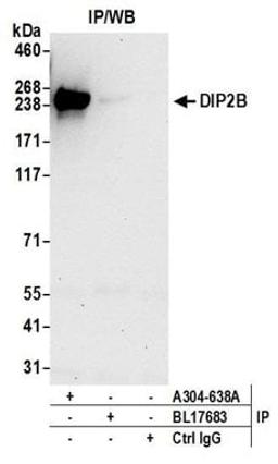 Detection of human DIP2B by western blot of immunoprecipitates.