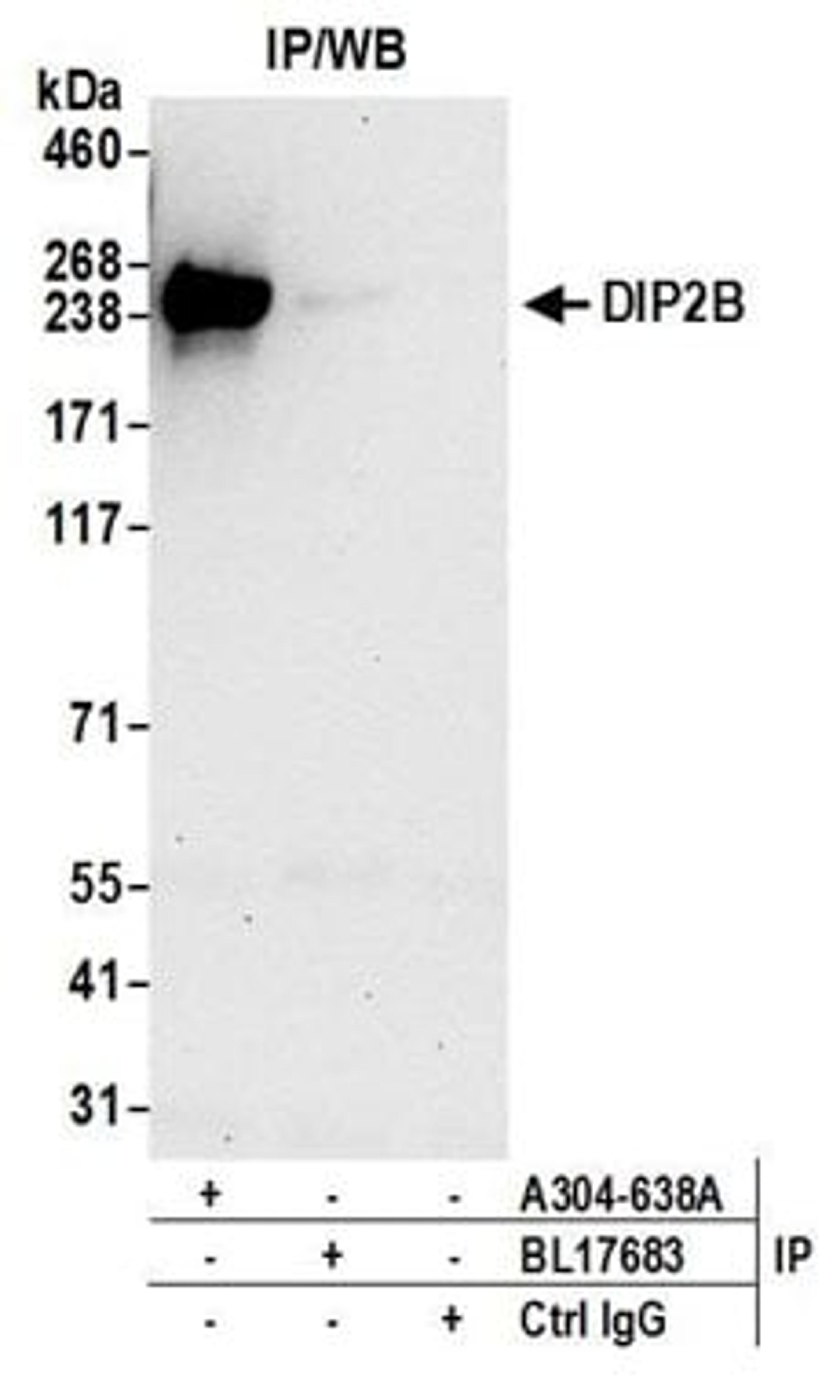 Detection of human DIP2B by western blot of immunoprecipitates.