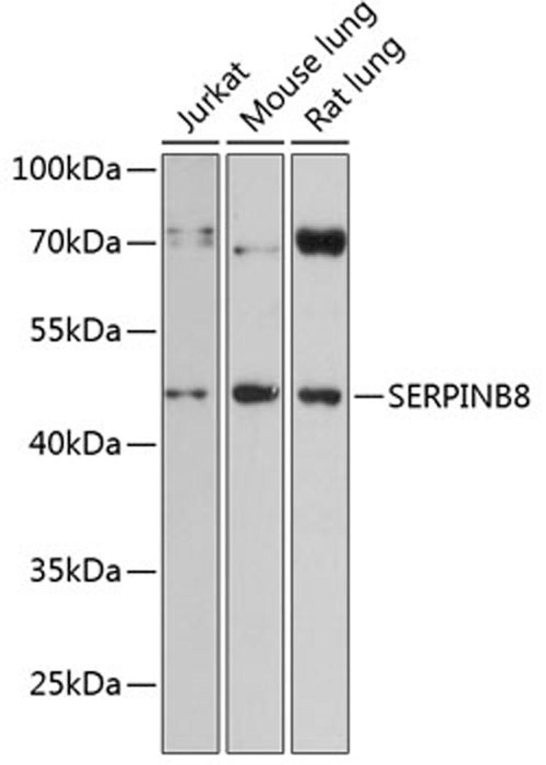 Western blot - SERPINB8 antibody (A13039)