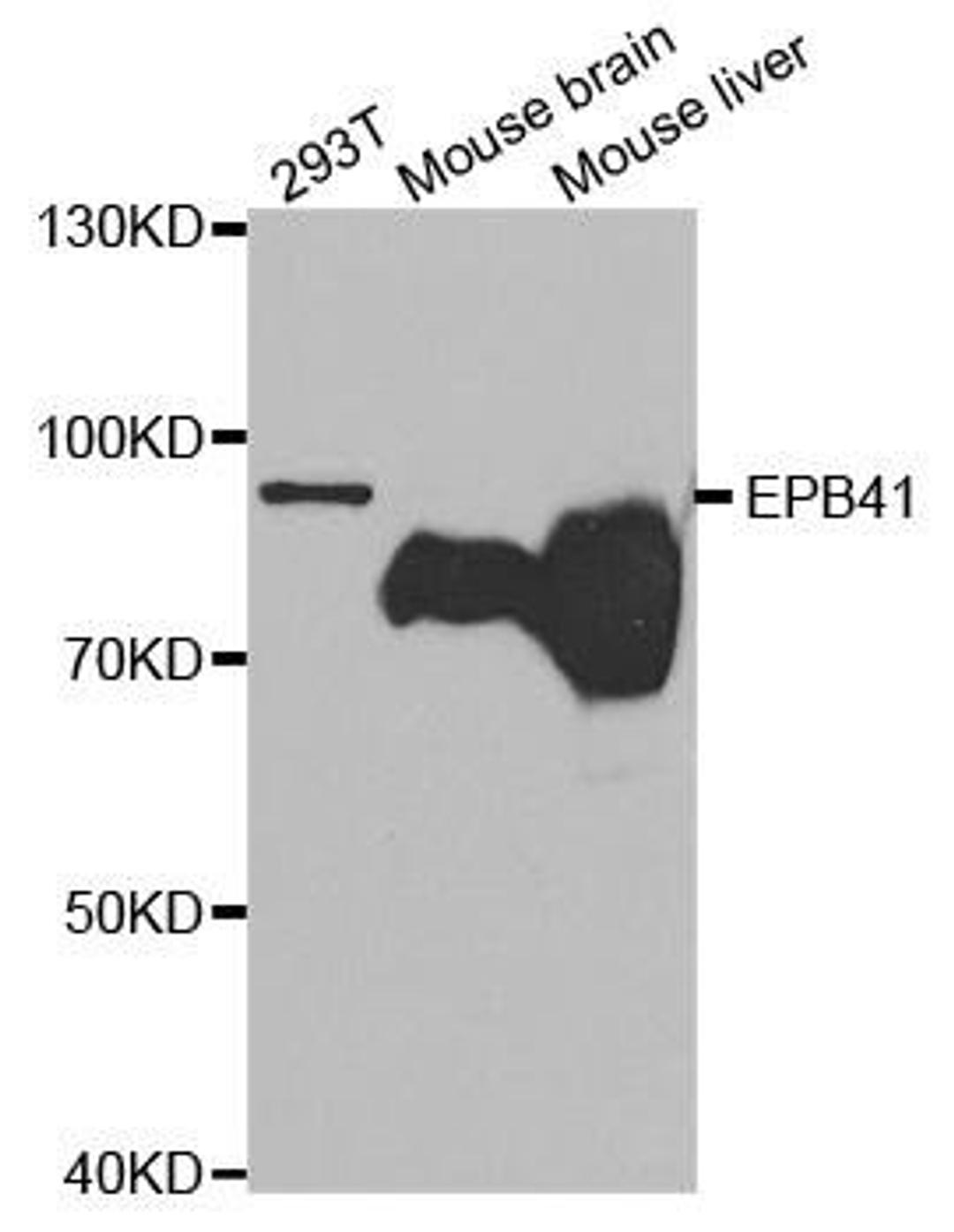 Western blot analysis of extracts of various cell lines using EPB41 antibody