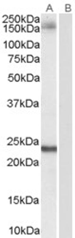 45-686 (0.1ug/ml) staining of Hela lysate (35ug protein in RIPA buffer). Primary incubation was 1 hour. Detected by chemiluminescence.