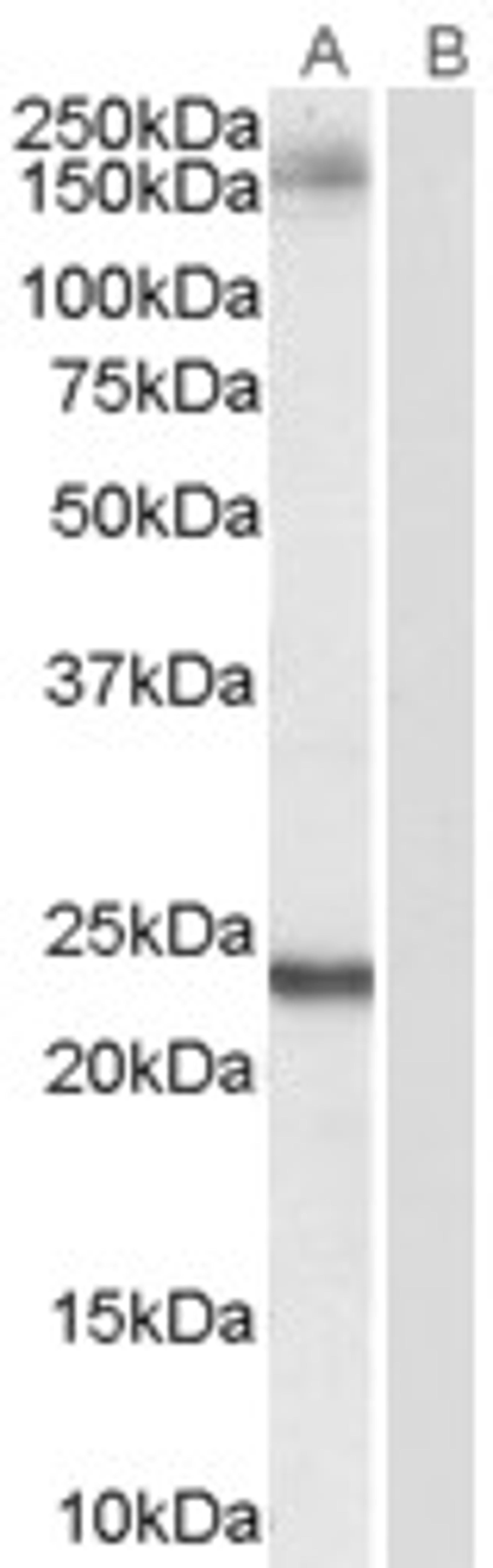 45-686 (0.1ug/ml) staining of Hela lysate (35ug protein in RIPA buffer). Primary incubation was 1 hour. Detected by chemiluminescence.