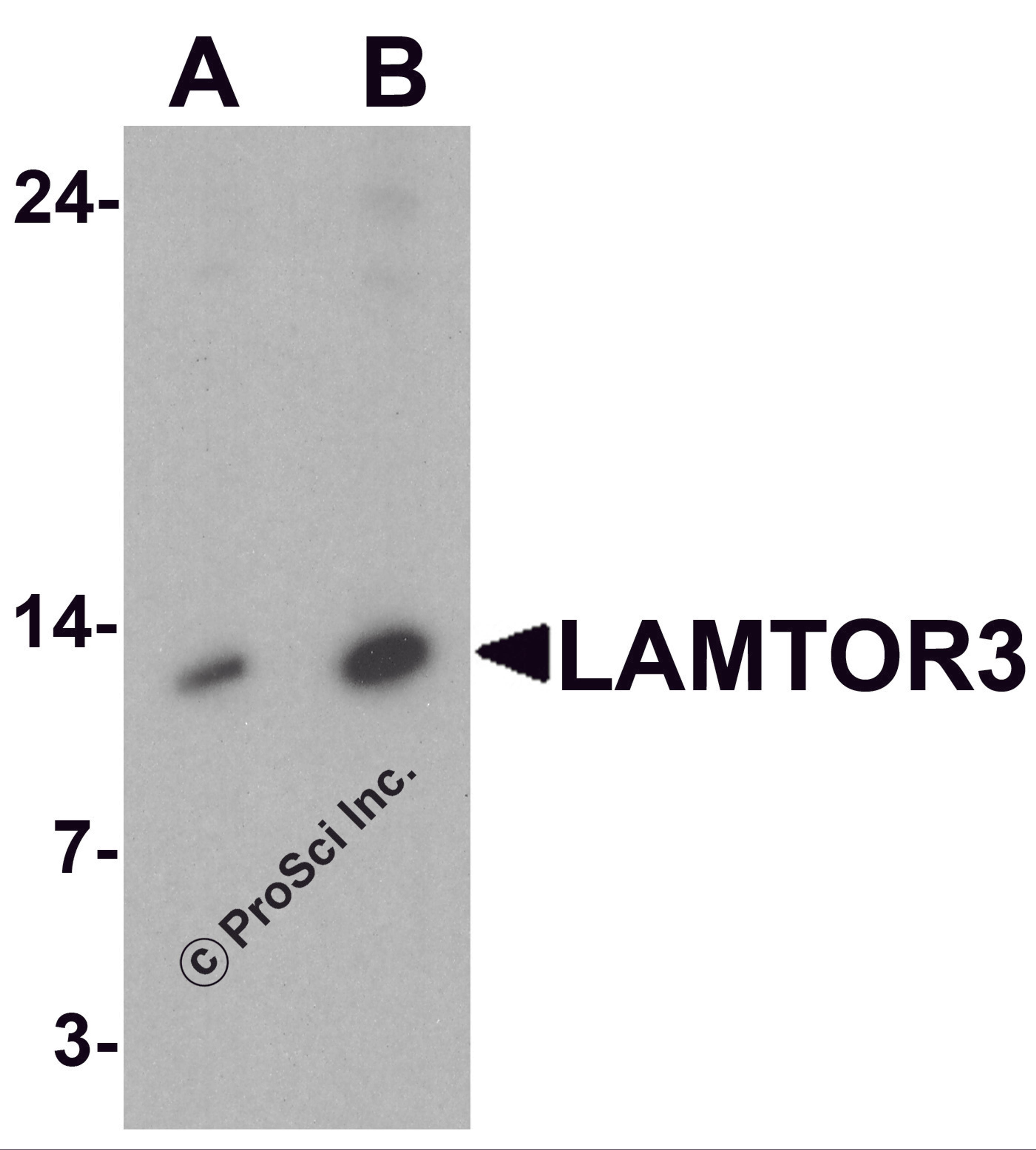 Western blot analysis of LAMTOR3 in human brain tissue lysate with LAMTOR3 antibody at (A) 1 and (B) 2 μg/ml