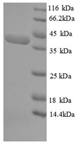 (Tris-Glycine gel) Discontinuous SDS-PAGE (reduced) with 5% enrichment gel and 15% separation gel.