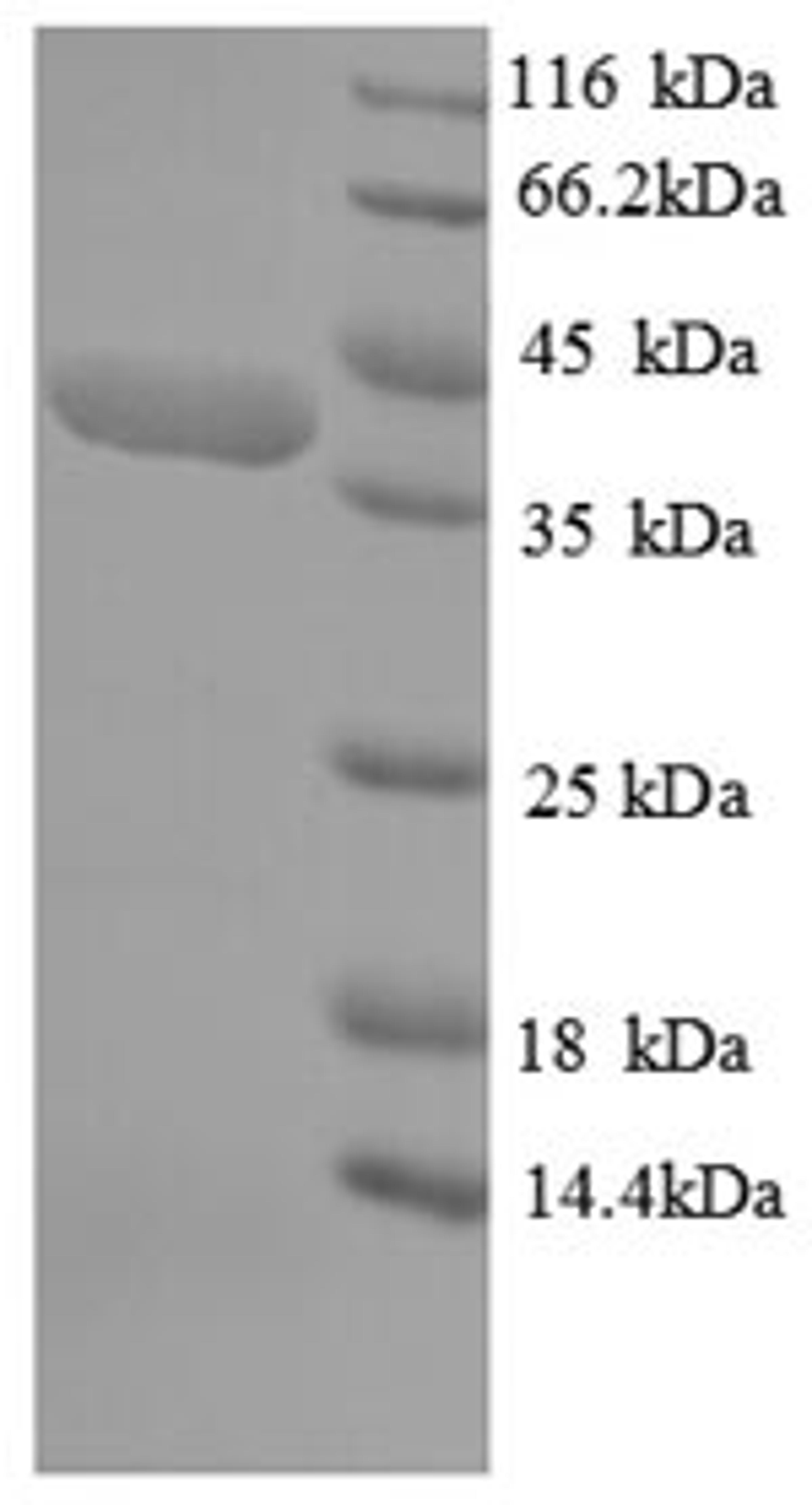 (Tris-Glycine gel) Discontinuous SDS-PAGE (reduced) with 5% enrichment gel and 15% separation gel.