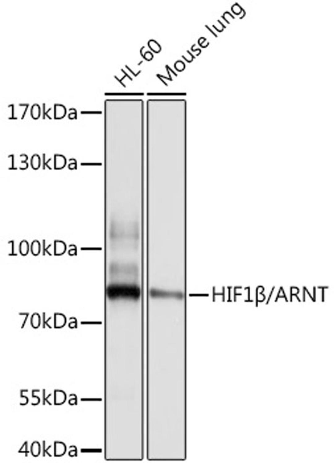 Western blot - HIF1ß/ARNT antibody (A0972)