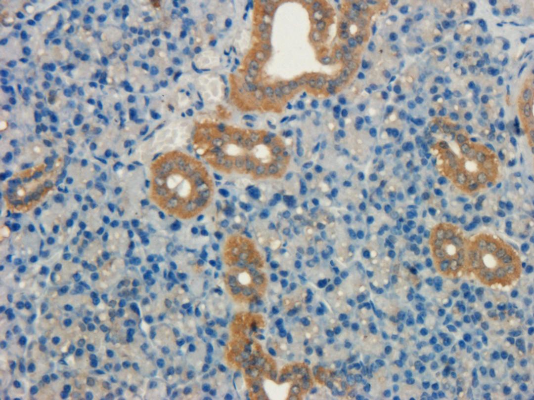 IHC-P image of mouse lymph node tissue using NRSF/REST protein antibody (dilution of primary antibody at 1:100)