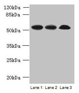 Western blot. All lanes: SPERT antibody at 7µg/ml. Lane 1: Rat gonadal tissue. Lane 2: Mouse lung tissue. Lane 3: A549 whole cell lysate. Secondary. Goat polyclonal to rabbit IgG at 1/10000 dilution. Predicted band size: 52, 48 kDa. Observed band size: 52 kDa