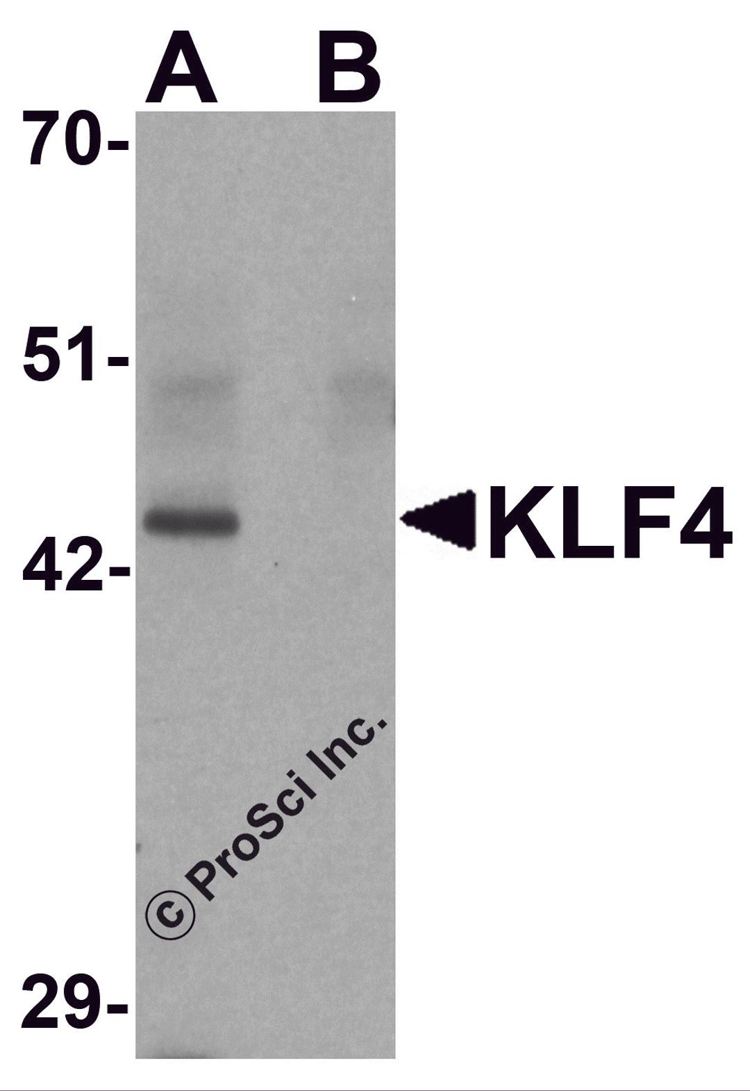 Western blot analysis of KLF4 in mouse liver tissue lysate with KLF4 antibody at 1 &#956;g/mL in (A) the absence and (B) the presence of blocking peptide.