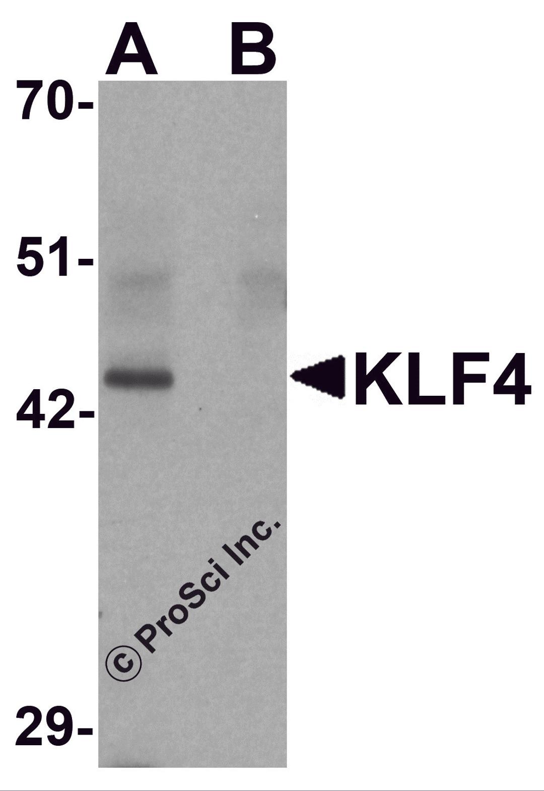 Western blot analysis of KLF4 in mouse liver tissue lysate with KLF4 antibody at 1 μg/mL in (A) the absence and (B) the presence of blocking peptide.