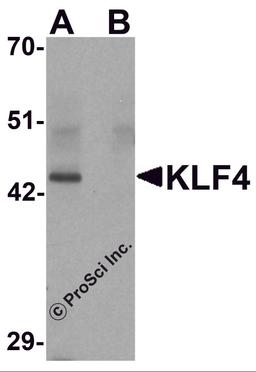 Western blot analysis of KLF4 in mouse liver tissue lysate with KLF4 antibody at 1 μg/mL in (A) the absence and (B) the presence of blocking peptide.