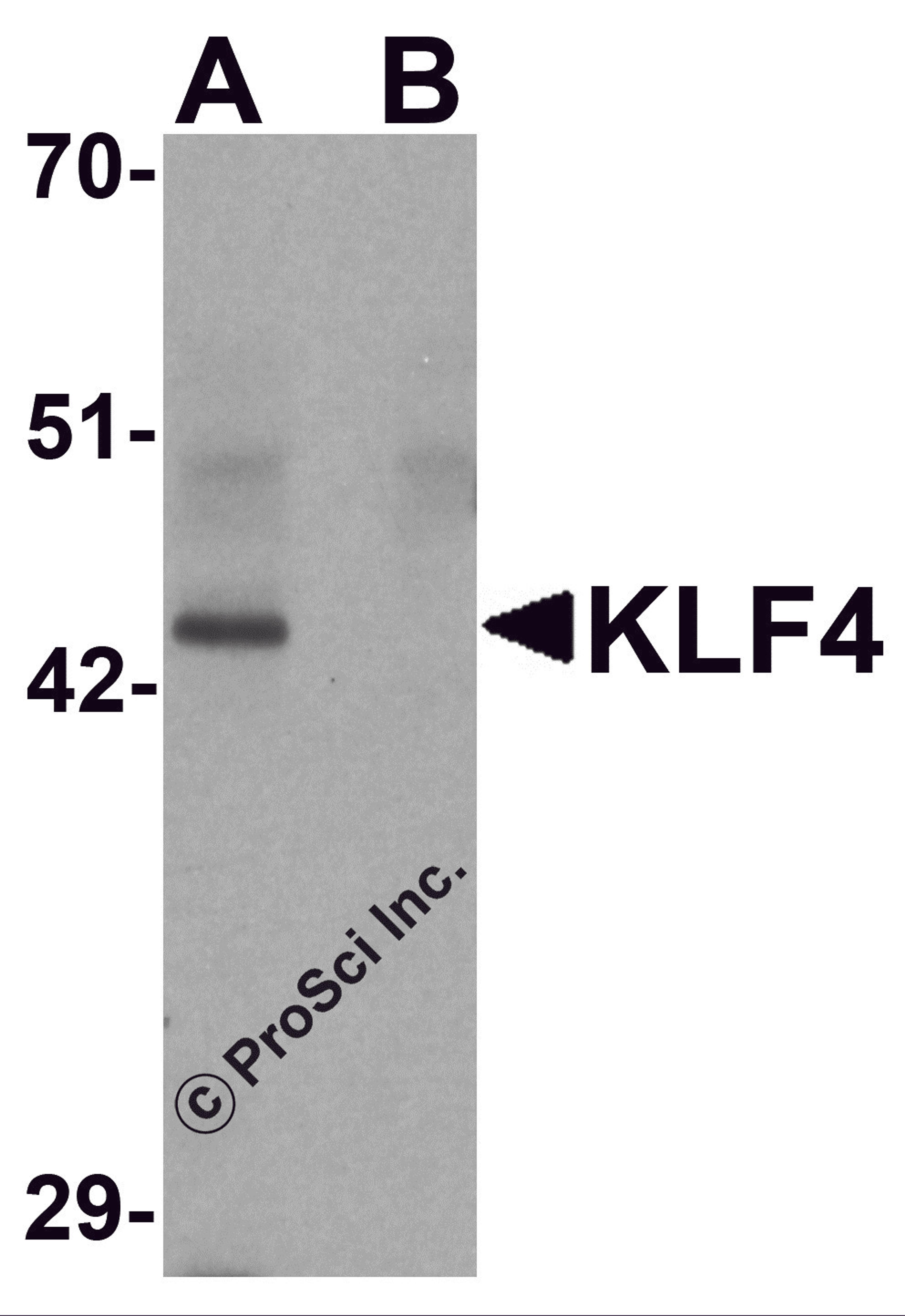 Western blot analysis of KLF4 in mouse liver tissue lysate with KLF4 antibody at 1 μg/mL in (A) the absence and (B) the presence of blocking peptide.