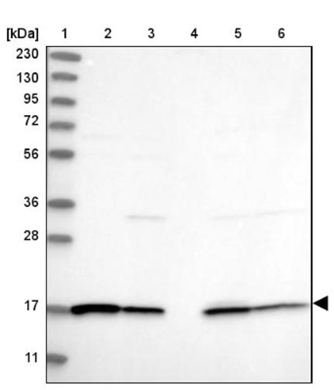 Western Blot: GRAF Antibody [NBP2-38235] - Lane 1: Marker [kDa] 230, 130, 95, 72, 56, 36, 28, 17, 11<br/>Lane 2: RT-4<br/>Lane 3: U-251 MG<br/>Lane 4: Human Plasma<br/>Lane 5: Liver<br/>Lane 6: Tonsil